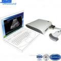 Cat / Dog etc. Animal Ultrasound Scanner with Software